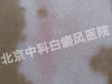  ҽԺ